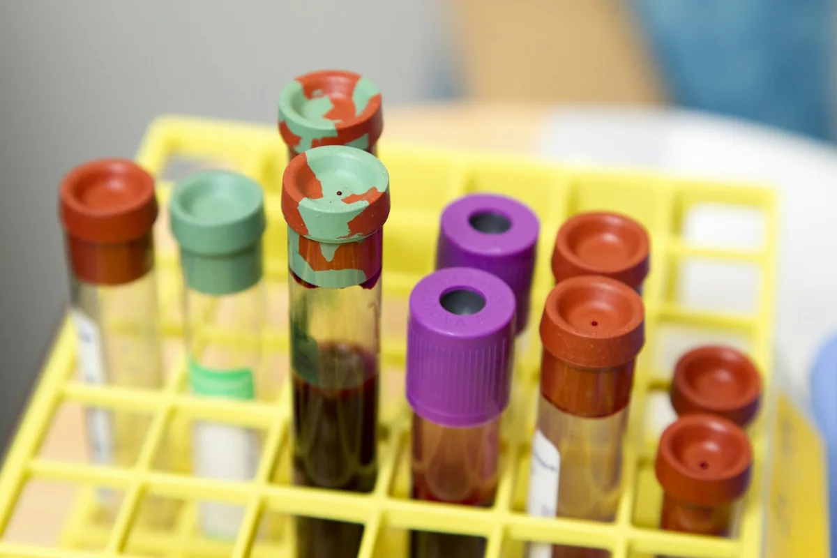 Epruveta me mostra gjaku në një mbajtëse laboratorike